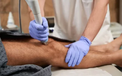 How Extracorporeal Shockwave Therapy (ESWT) Can Help Reduce Knee Pain