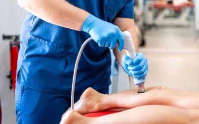 Extracorporeal Shockwave Therapy