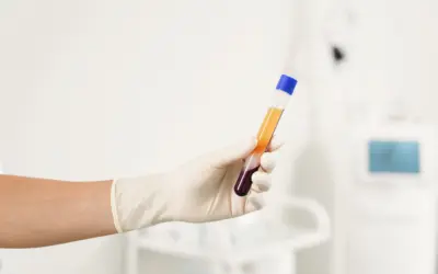 Does PRP Actually Work? What the Latest Research Says